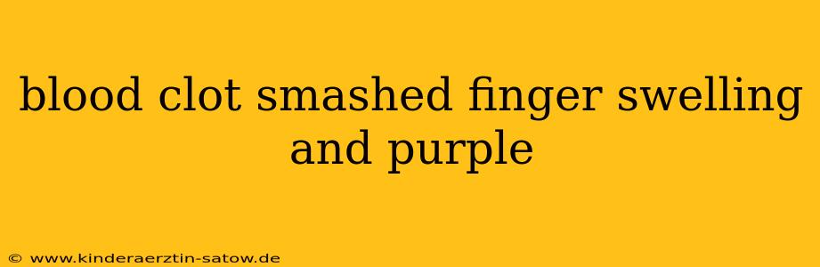 blood clot smashed finger swelling and purple