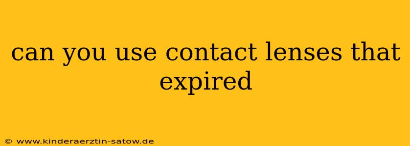 can you use contact lenses that expired