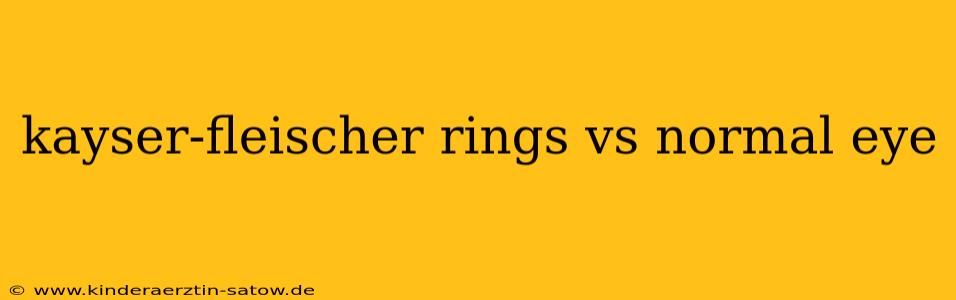 kayser-fleischer rings vs normal eye