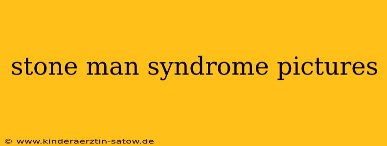 stone man syndrome pictures